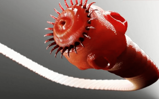 паразитический червь из человеческого тела